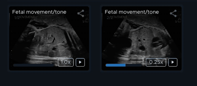 Clip in image gallery-1