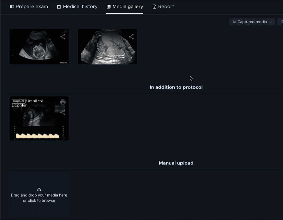 Manual image upload GIF